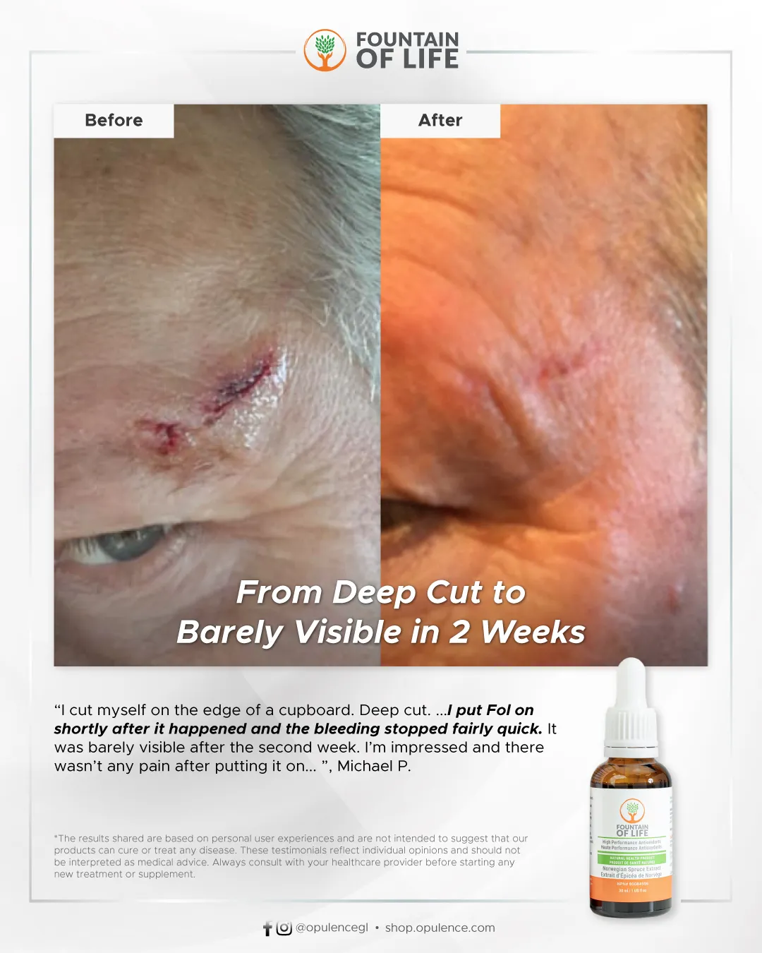20250522-FOL-Before-After-DeepCut
