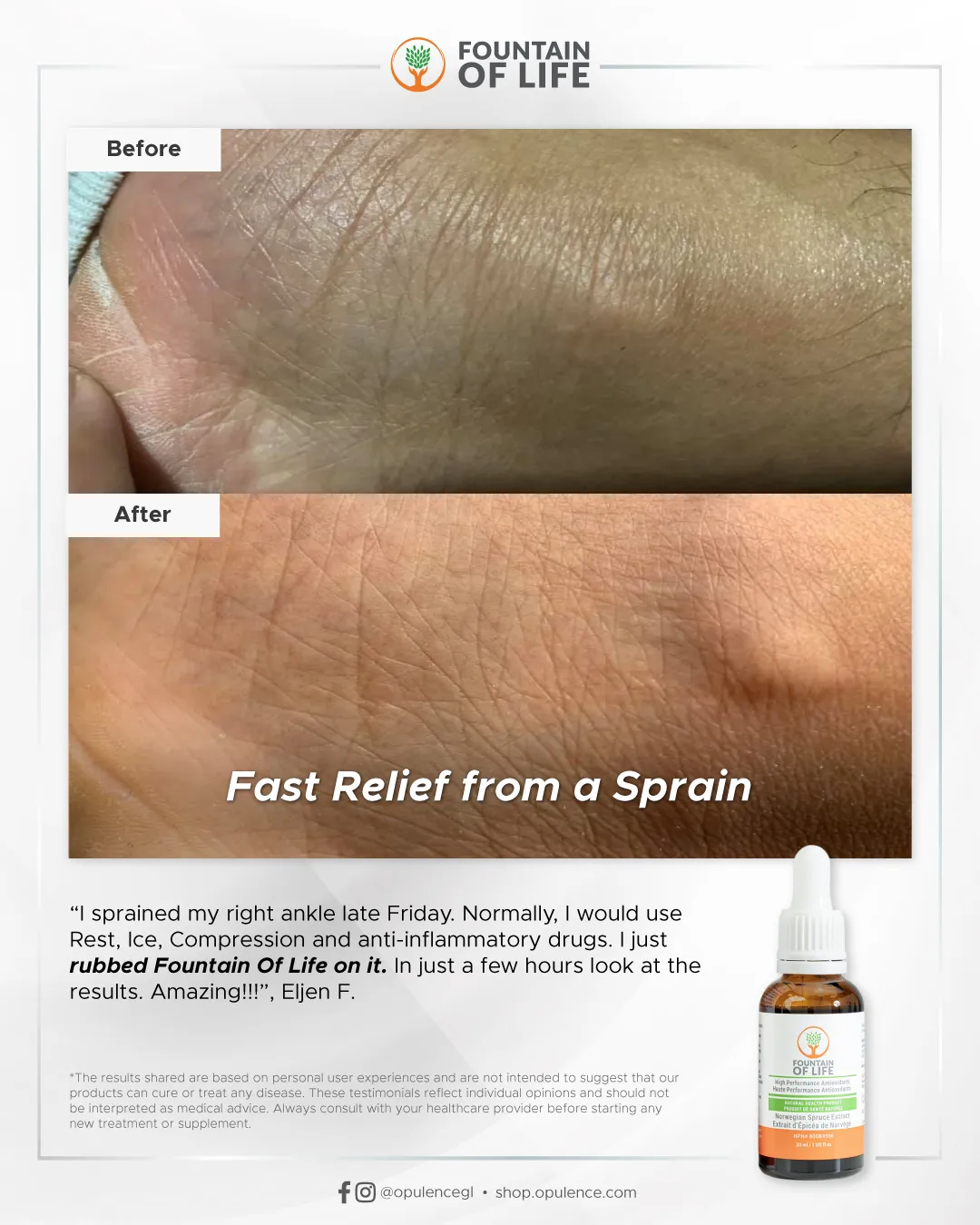 20250605-FOL-Before-After-ReliefFromSprain